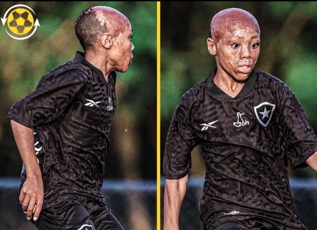 From Near-Fatal Accident to Football Dream: Botafogo Signs Inspirational Academy Prospect Bernardo Lopes